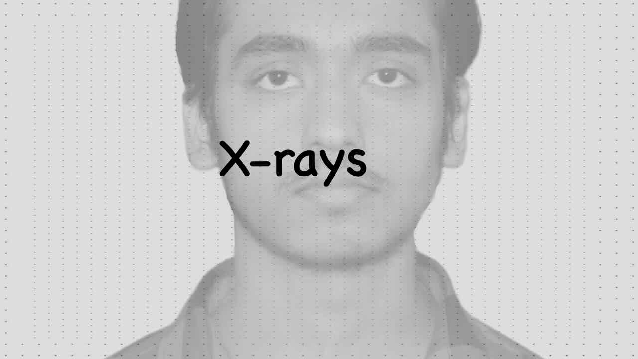 X-rays