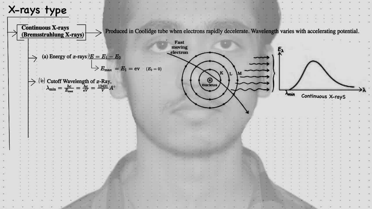 1. X-Rays/X-Rays types.